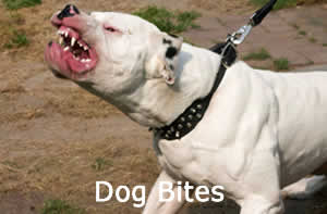 Dog Bite Attorney Kissimmee